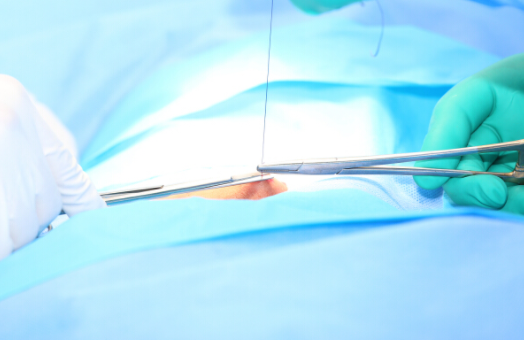 做完手術需要注意什麼？