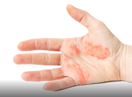 造成兒童燙傷的主要原因