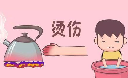孩子預防燙傷疤痕如何做