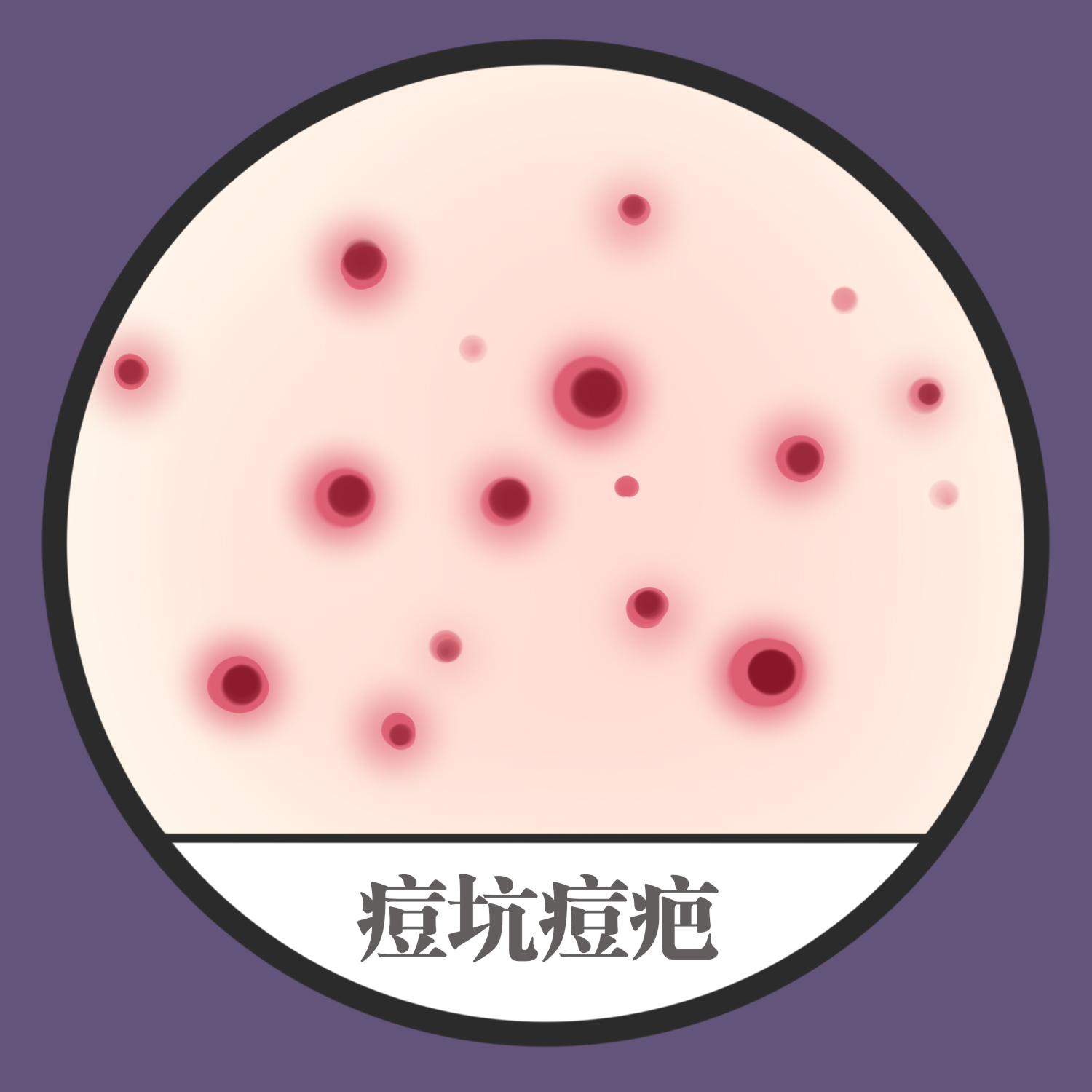 痘坑與痘印的區別